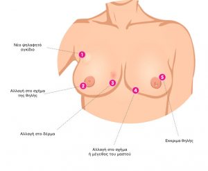 Απεικόνιση σημείων και τα συμπτωμάτων του καρκίνου του μαστού